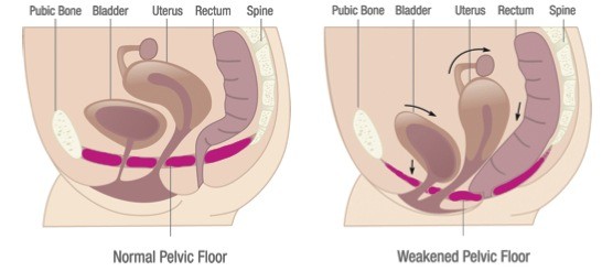 Barrie Pelvic Floor Physiotherapy