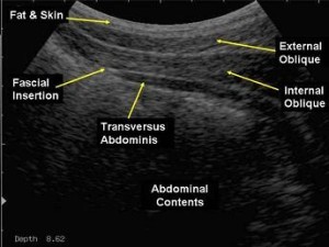 real time ultrasound Victoria